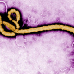 Electron microscope image of the Ebola virus particle showing its filamentous structure in yellow against a purple background.